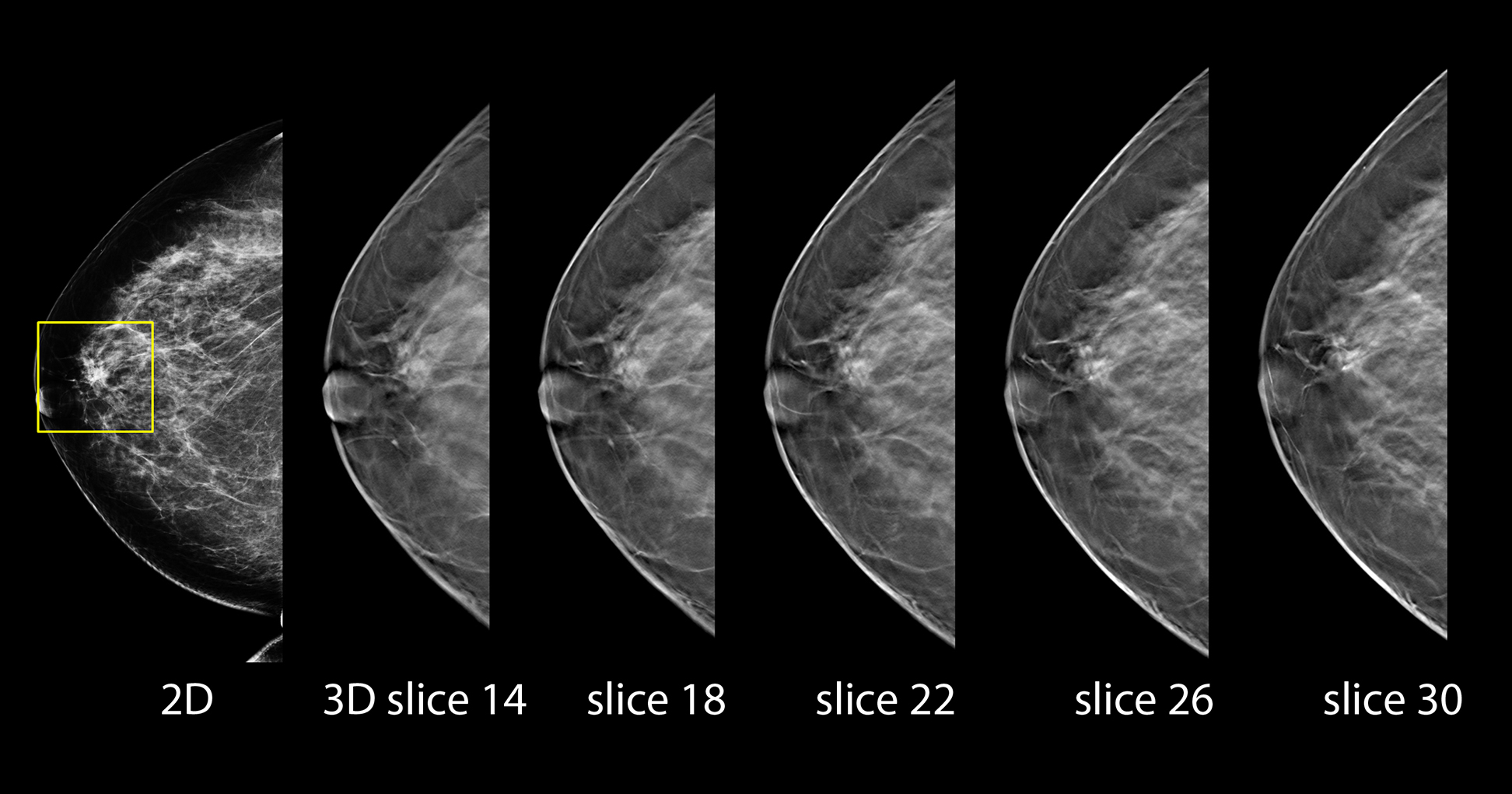 Case 178301- Suspicious Lesion (1)