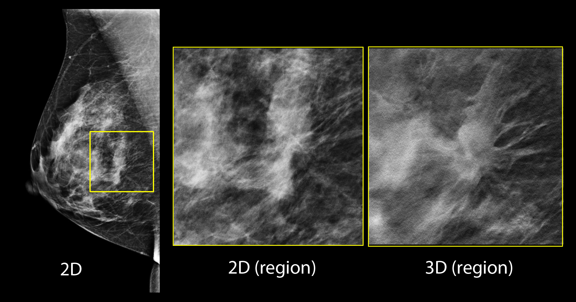 Case 178301- Suspicious Lesion