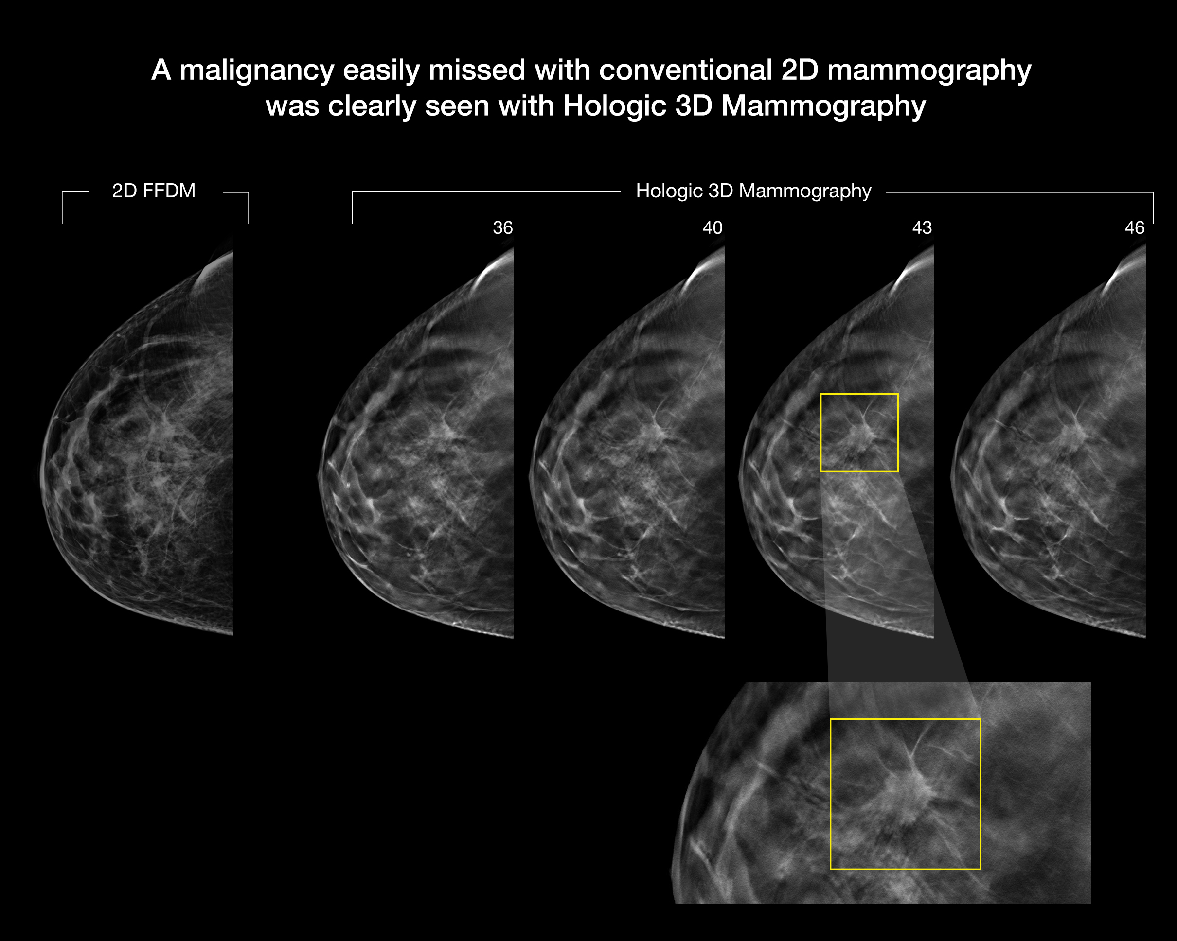 casestudy_cancerdiagnosed_0